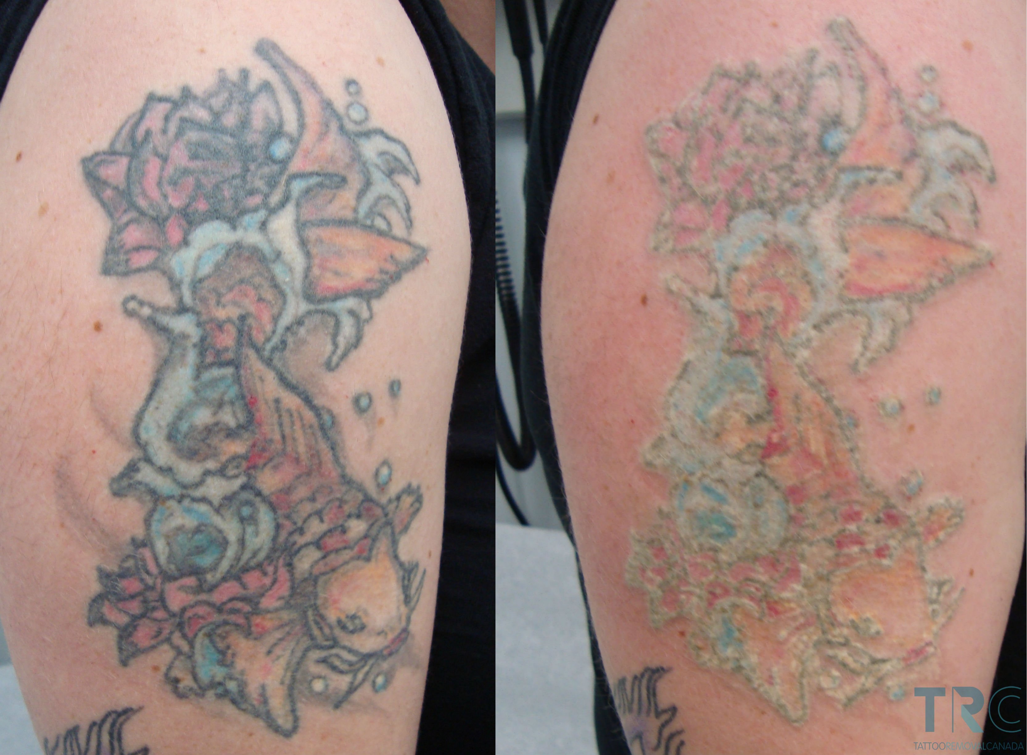 How to Fix a Smudged or Faded Tattoo Stencil - wide 5