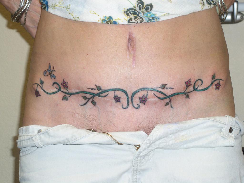 Of Tattoo Over Tummy Tuck Scar Tattoo. 