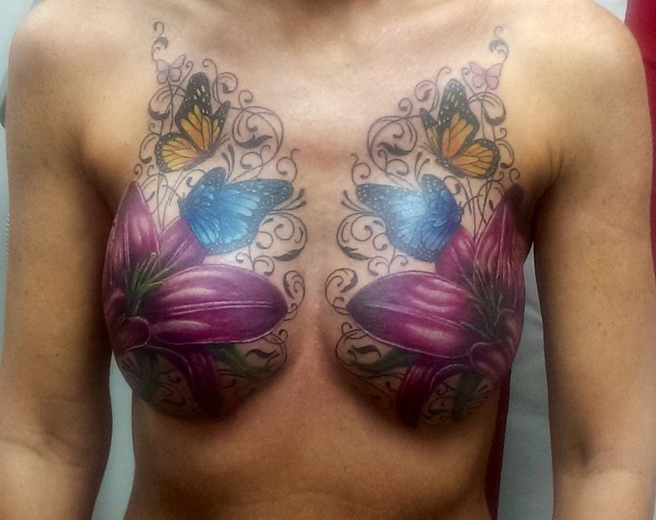 Breast Cancer (IBC) on Pinterest, Mastectomy tattoo, Lymph nodes and. 